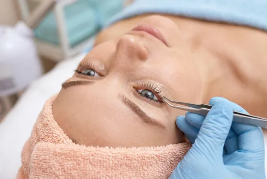 Dépose de cils
